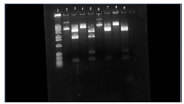 plasmid gel 2